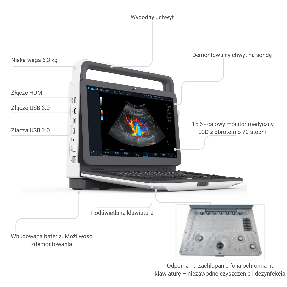 aparat usg zoncare m70 cechy