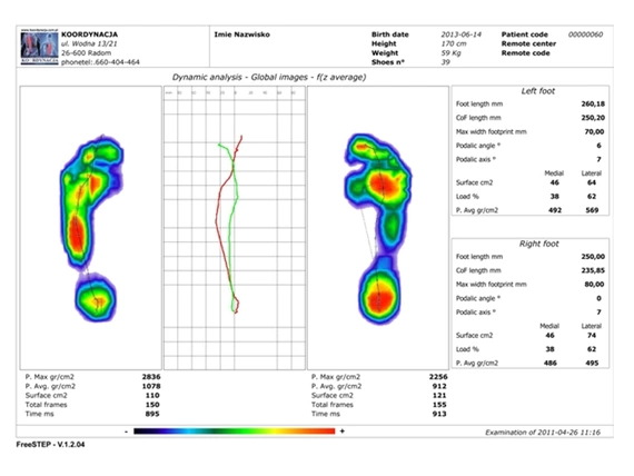 Kompletny system do oceny równowagi, chodu, stóp i postawy ciała FreeMed Posture (Podoscan 2D + Platforma sił reakcji podłoża + pasywne planty + Videografia 2D)