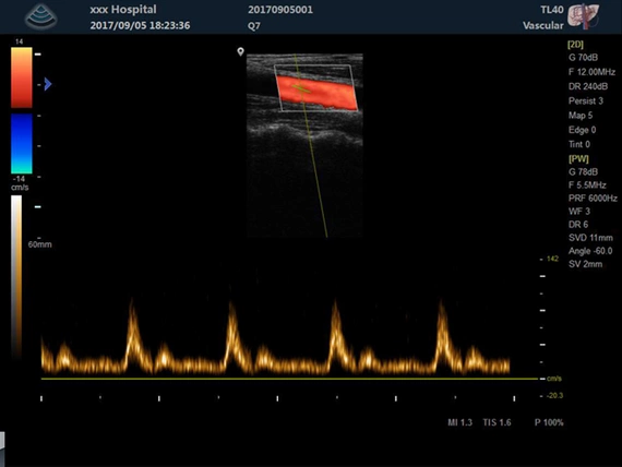 Aparat ultrasonograficzny Zoncare M5 z głowicą kardiologiczną