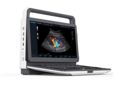 Mobilny aparat USG Zoncare M70 z głowicą convex